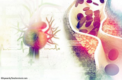 cerebrovascular graphic