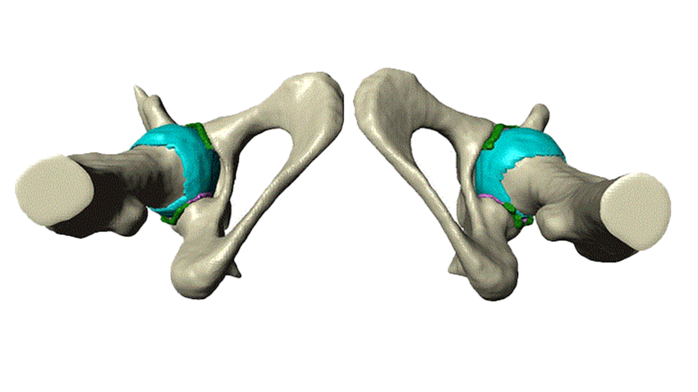 Hip Preservation Modeling