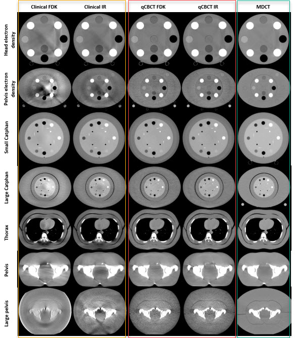 ImageComparison